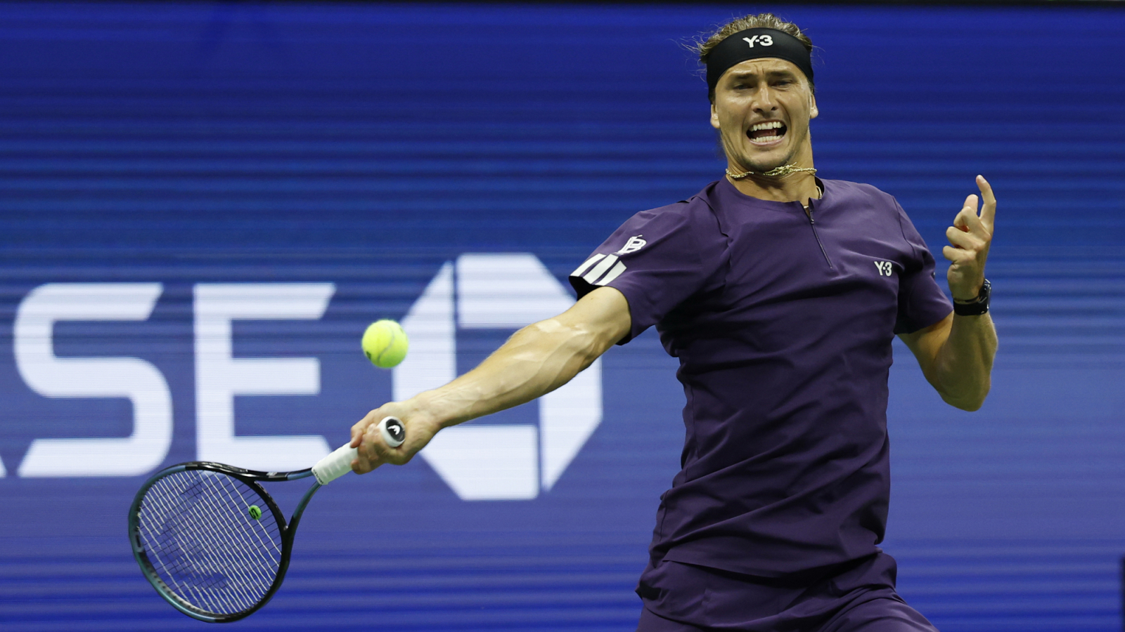 Alexander Zverev Shares Important Update on his Back Problems at the US Open