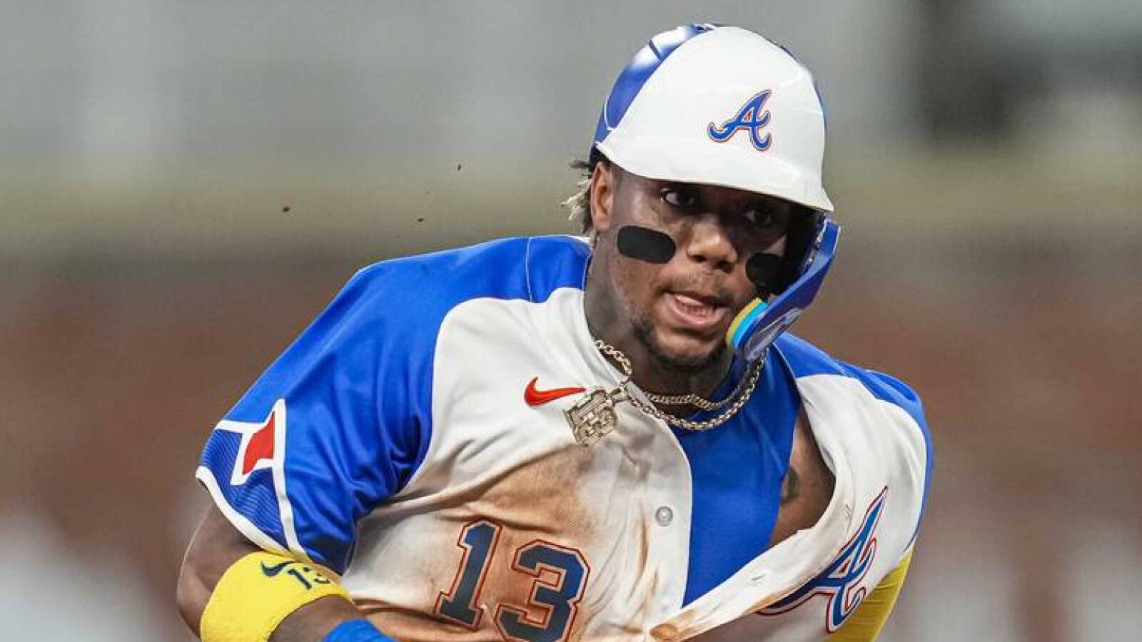 Braves get encouraging news after MVP favorite Ronald Acuna Jr. leaves game