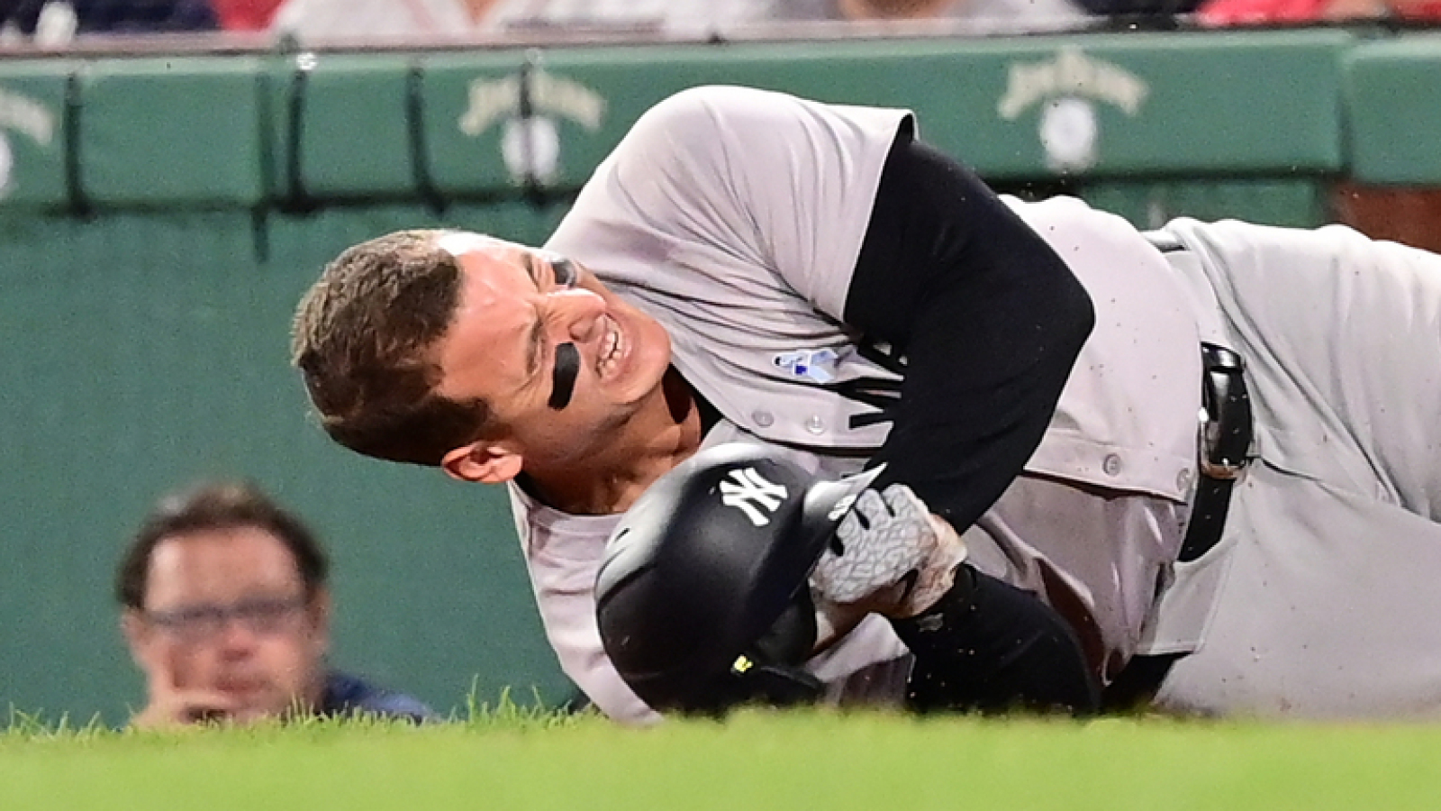Yankees' Anthony Rizzo to miss time with right arm fracture