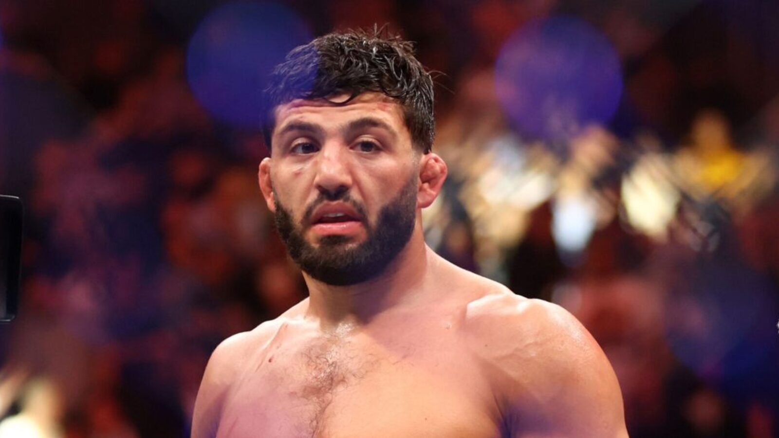 Arman Tsarukyan Breaks Finger In Bizarre Hotel Incident