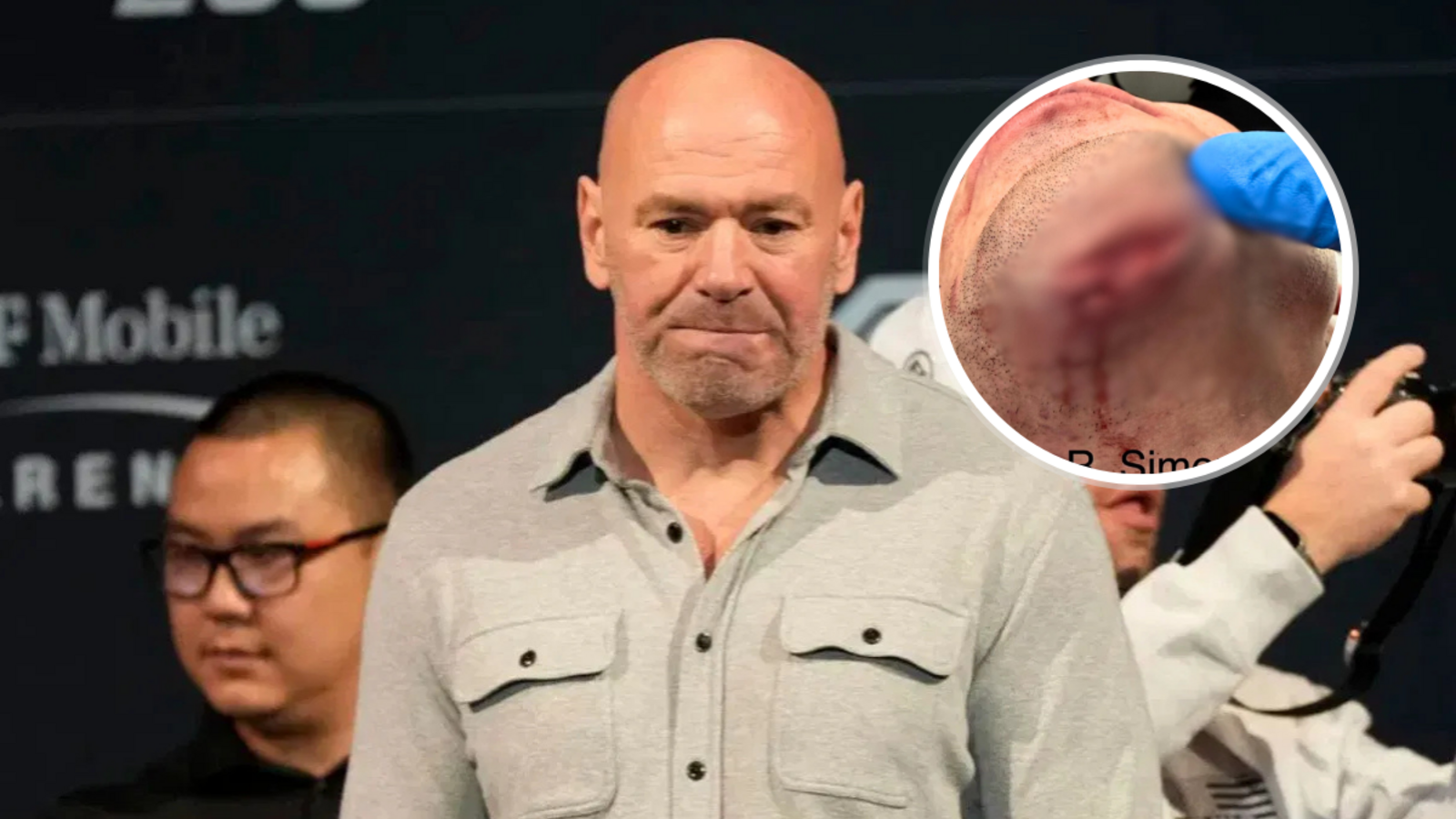 Dana White Issues Medical Update After UFC Vegas 111 Fighter Suffers Nasty Cut