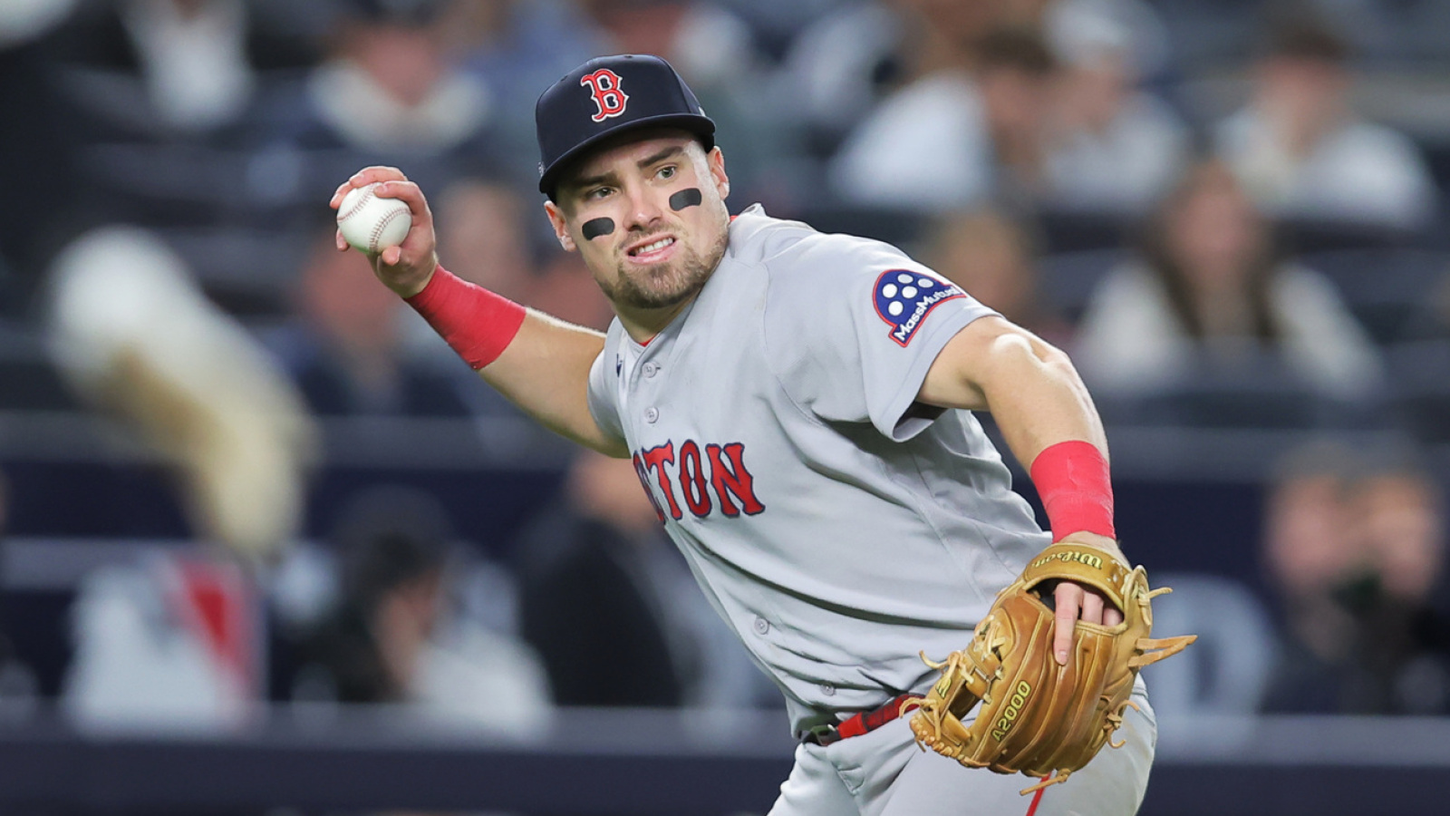 Caleb Durbin Undergoes Foot Surgery