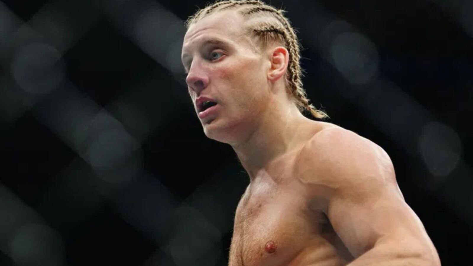 Title Paddy Pimblett Losses: Who Has Defeated the UFC Star?
