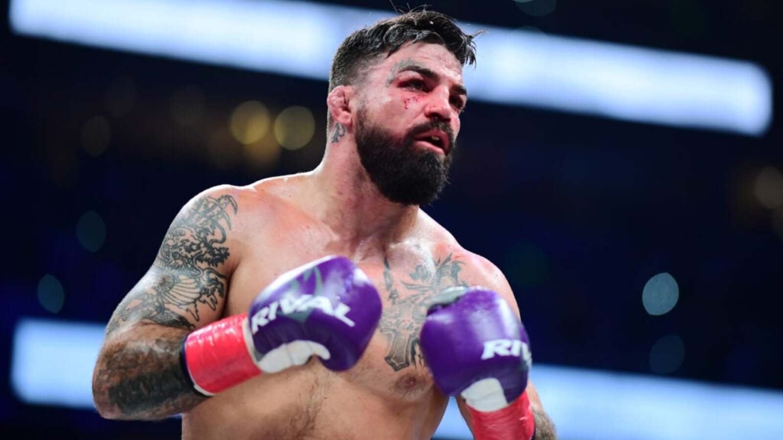 Mike Perry addresses concerns after showing off injury just weeks out from Nate Diaz Netflix fight