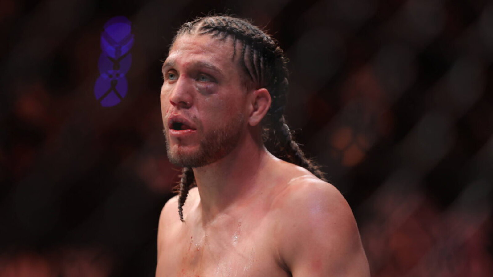 Brian Ortega Withdraws from UFC 331 Fight Against Renato Moicano Due to Injury